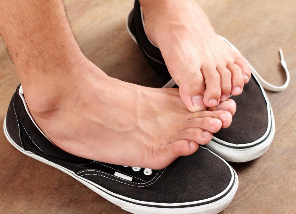An antifungal cream may be used to treat athlete's foot.