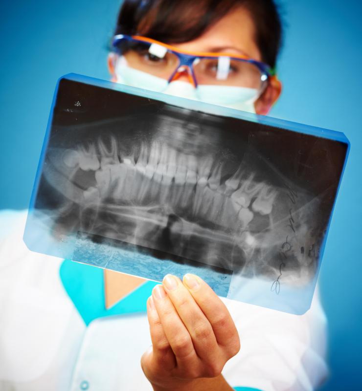 A dental X-ray may be conducted prior to applying crowns to a mulberry molar.