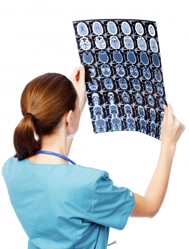 A brain scan can help a doctor determine the cause of neuralgia and whether it can be treated with surgery.