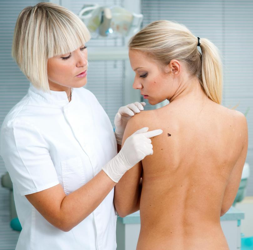 A doctor may perform a biopsy of a suspicious mole to determine whether it is cancerous.