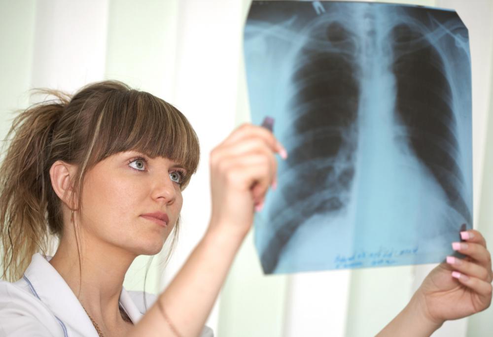 Chest x-rays are performed to determine the location of cysts.