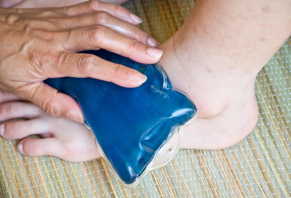 Icing the foot may help to relieve foot cramps.