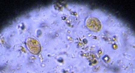 The Giardia parasite can cause dysbiosis symptoms.