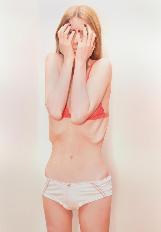 Eating disorders may cause permanent damage to the metabolism.