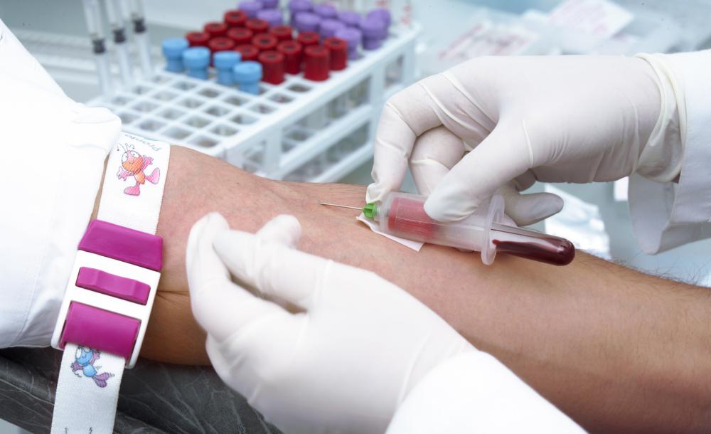 Blood samples are analyzed to identify specific proteins and their concentrations through the ELISA method.