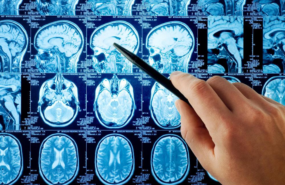 CT scans or X-rays of the head or skull can help to confirm a diagnosis of chronic mastoiditis.