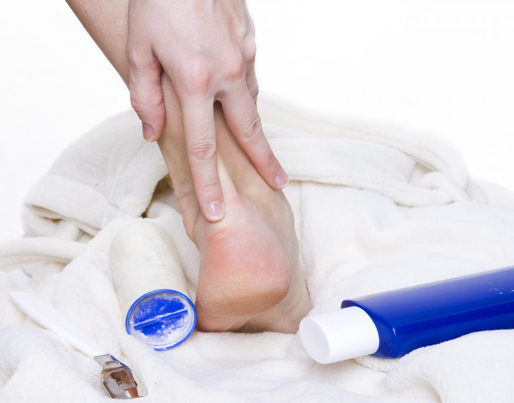 Calluses occur from repeated stress on the skin, such as a shoe rubbing on the back of the foot.