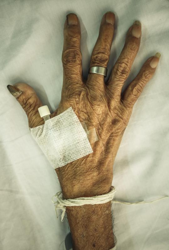 Cracking knuckles may result in arthritis.