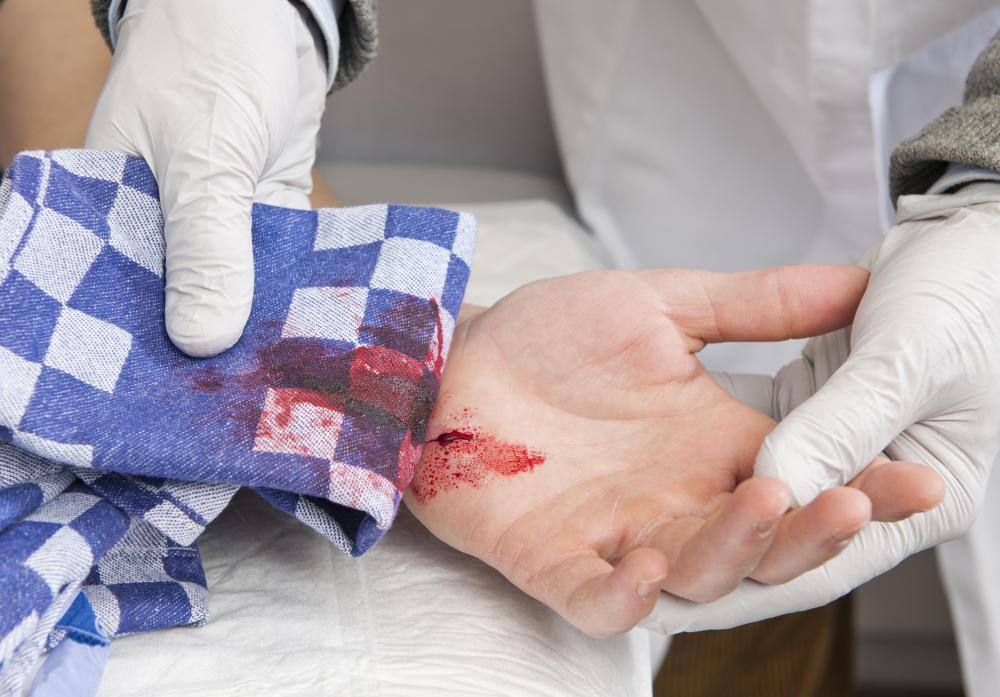 A hand injury can cause hand swelling and bleeding.