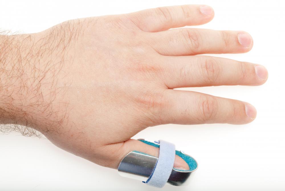 A splint is often an ideal way to keep a dislocated thumb immobilized.
