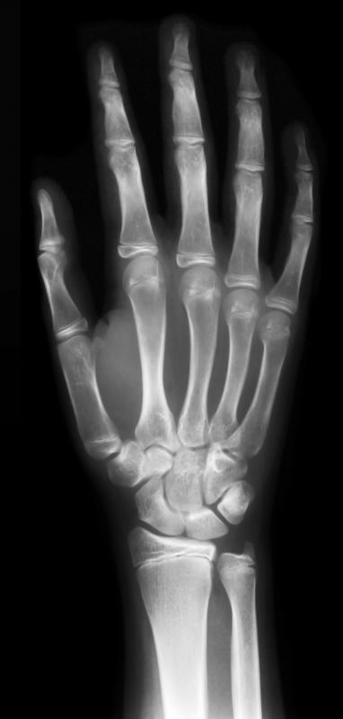 An X-ray, a type of diagnostic imaging.