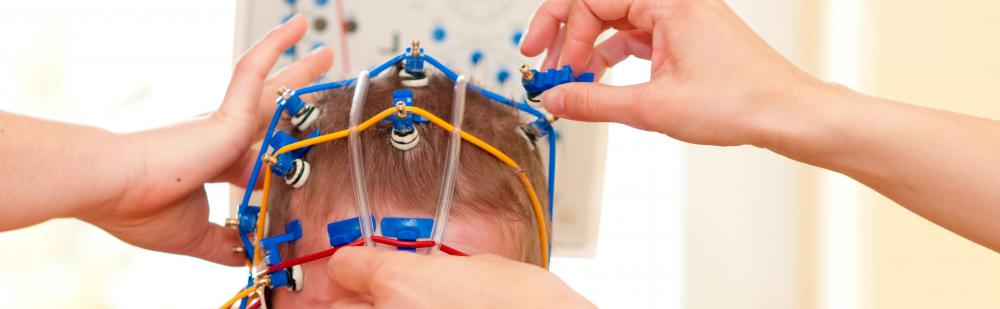 Brain waves, including mu waves, may be measured through EEG tests.