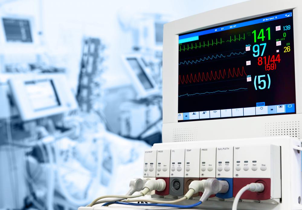 Visitors may be overwhelmed by the number of machines in the ICU.