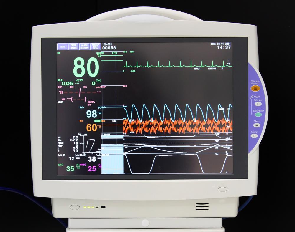 Heart monitoring is conducted continuously during the four to six hours following ablation.