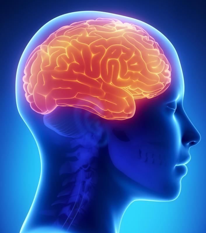 Suffering from an actual brain infarction may trigger the same short-term memory loss as depicted by a brain fart.
