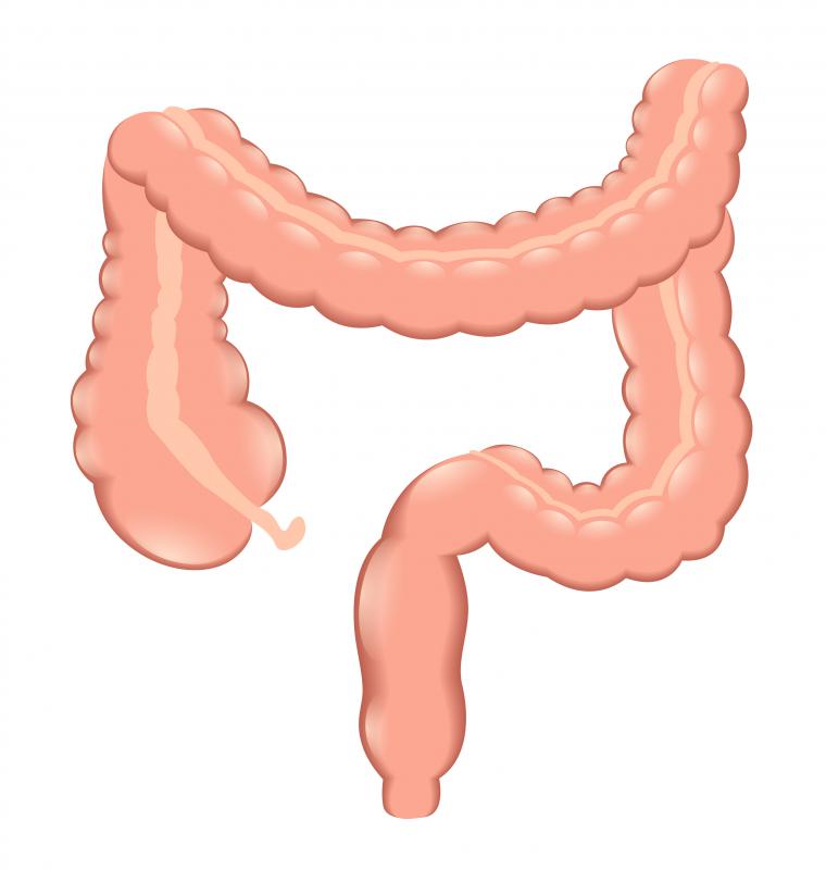 Fecal matter builds up in the colon and can interfere with absorption of nutrients.