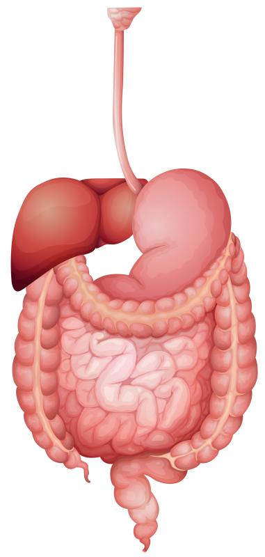 Hyperplastic polyps refer to benign tumors of the small bowel.