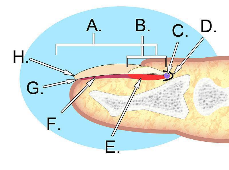 Onychomadesis is a condition which involves the separation of the nail plate (A. above) from the nail matrix (E. above). The nail matrix is the layer of tissue that the nail rests on.