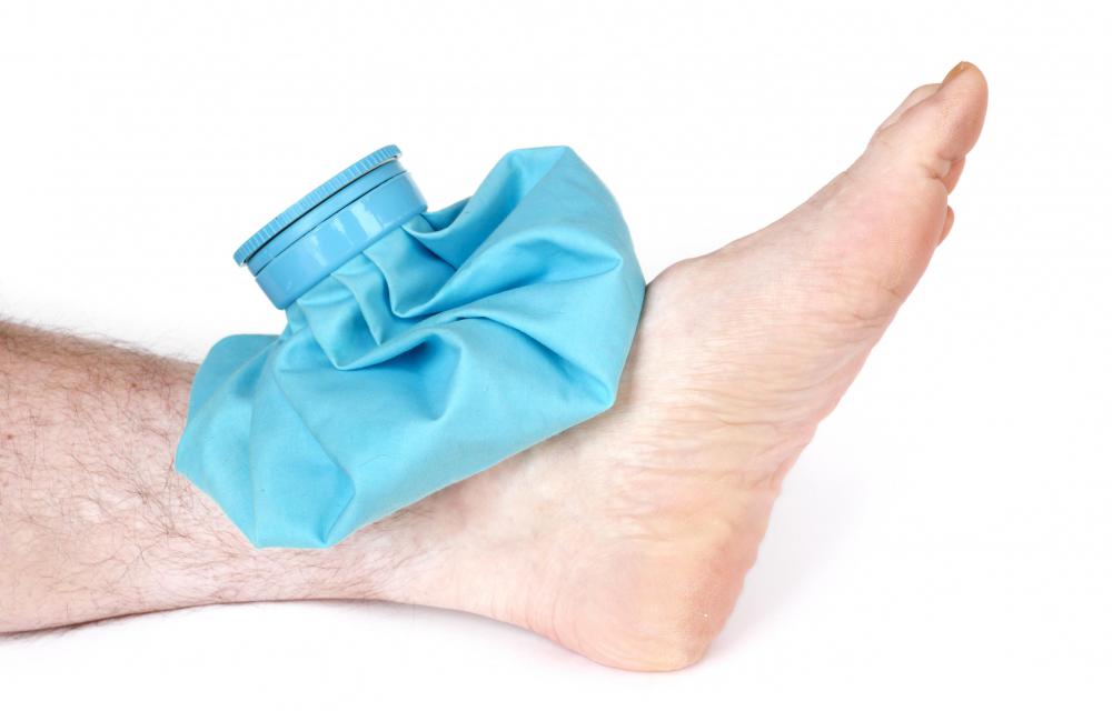 Ice packs can be applied to feet to help bring the swelling down.