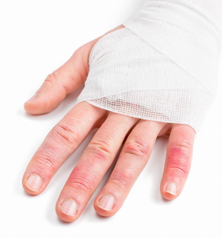 Certain types of trauma to the hands can cause knuckle swelling.