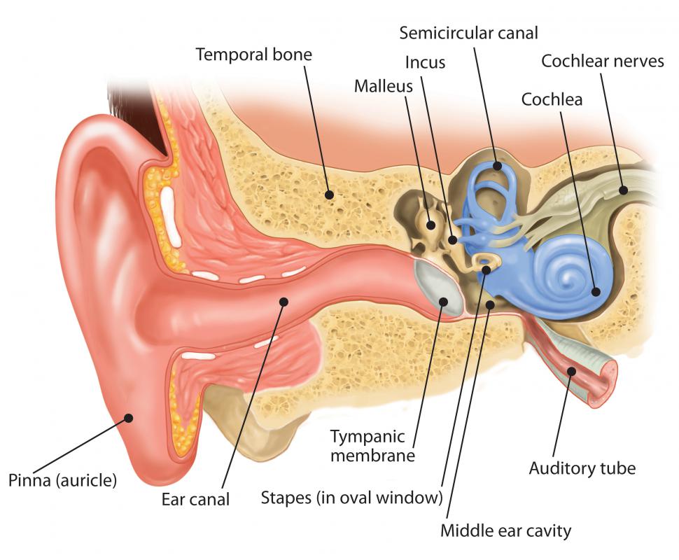 Earwax buildup can cause hearing loss and earaches.