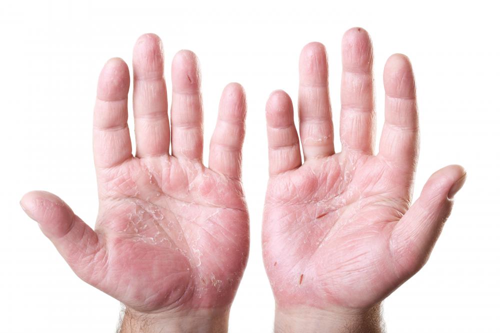 Hand reflexology may help relieve hand pain.