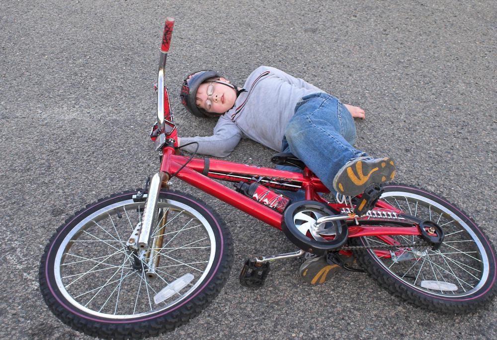 A thumb spica splint may be required if someone experiences a bad fall.