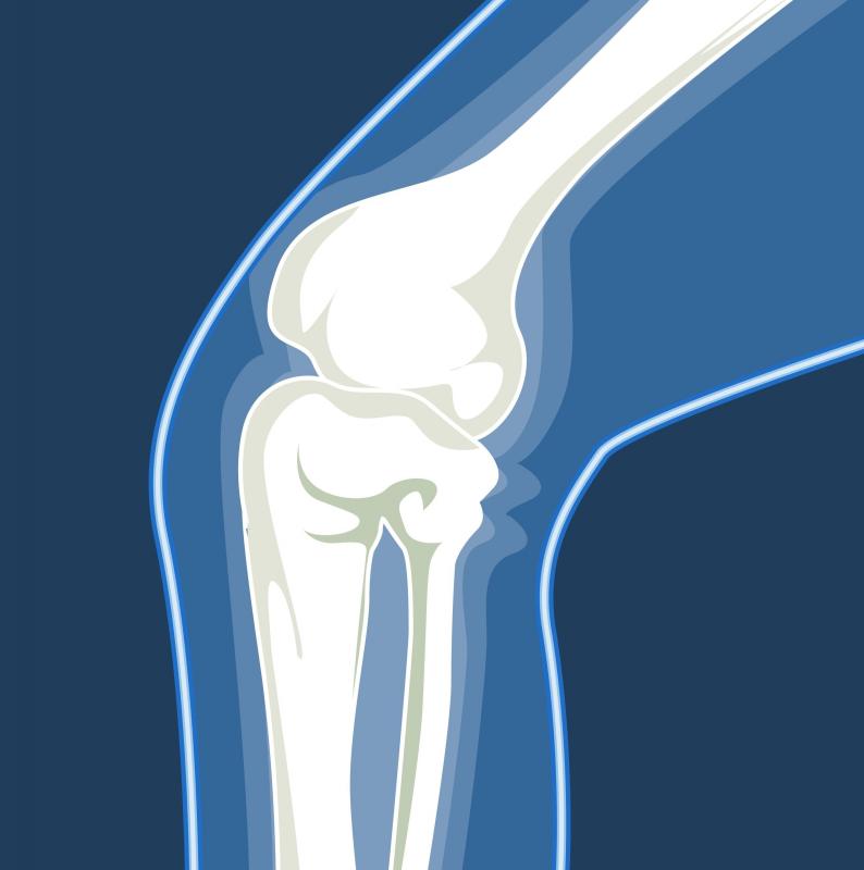 The popping sound made when a joint cracks comes from the tendons and ligaments moving or from changes in synovial fluid.