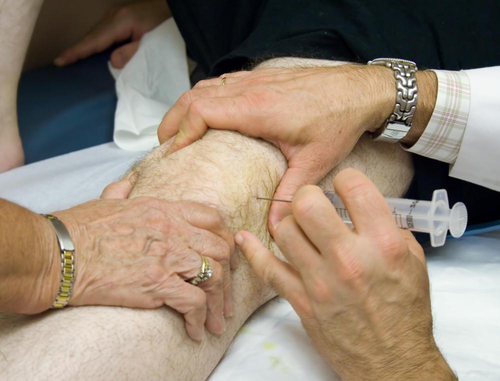 Steroid injections are a possible form of treatment if knee pain from bipartite patella does not subside from other treatments.