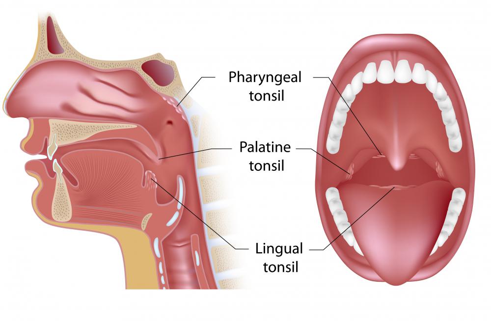 The palatine tonsils, commonly simply referred to as the tonsils, lie at the side wall of the posterior pharynx.
