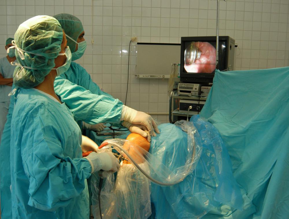 A laparoscopy may be performed to treat an inguinal hernia.
