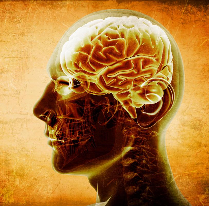 MRI and CT scanning are diagnostic imaging tests used to diagnose and evaluate brain stem tumors.