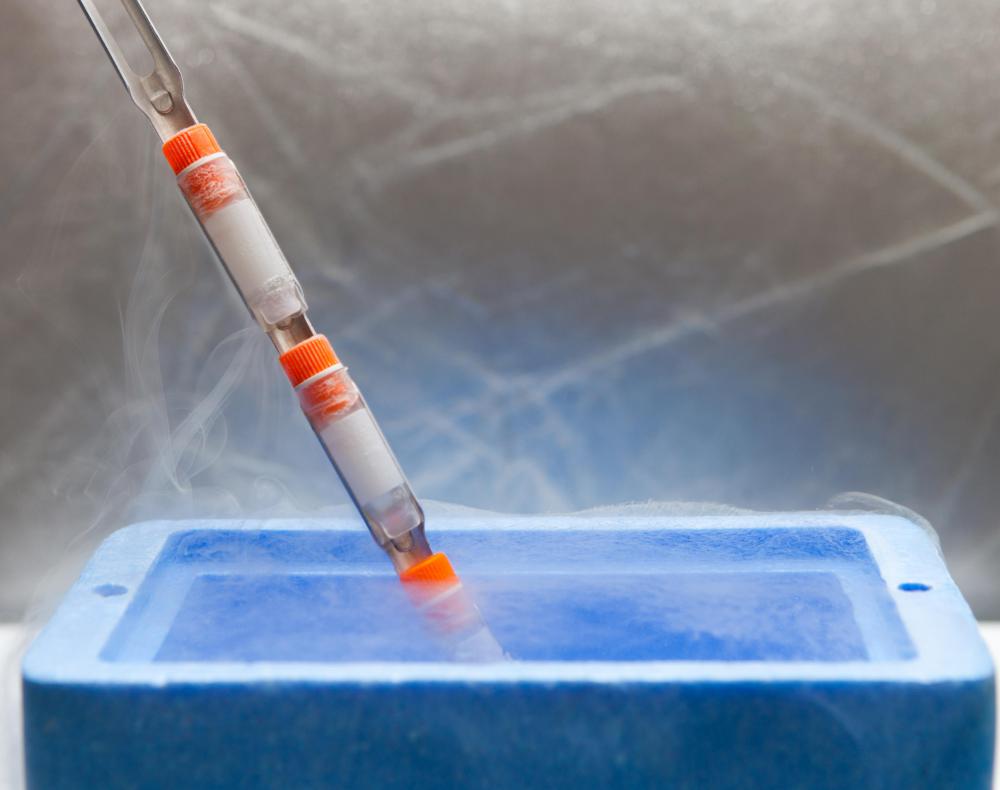 If sebaceous keratosis is a problem, a doctor can freeze the lesion with liquid nitrogen.