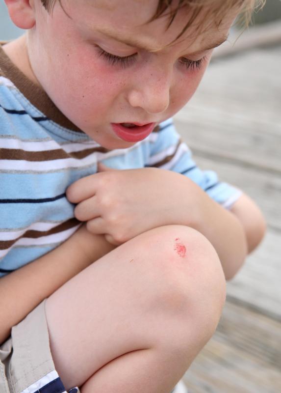 Rubbing alcohol can be used as an antiseptic on minor scrapes.