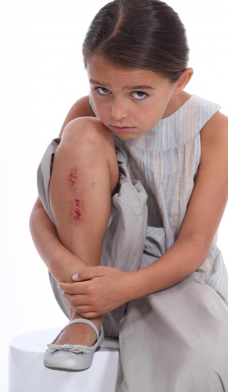 An antiseptic may be applied to cuts and wounds for anti-bacterial purposes.