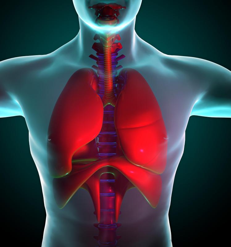 Adenocarcinoma is extremely common in the lungs.