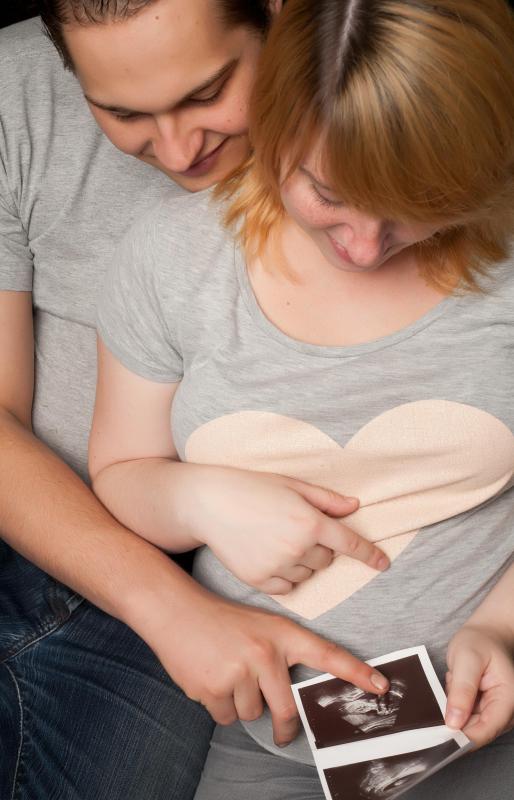 A sonogram photo is often a cherished keepsake for expectant parents.