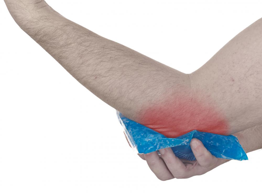 Initial treatment for a condyle fracture usually involves ice.