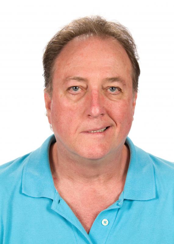 Victims of a major ischemic attack often display drooping on one side of the face.