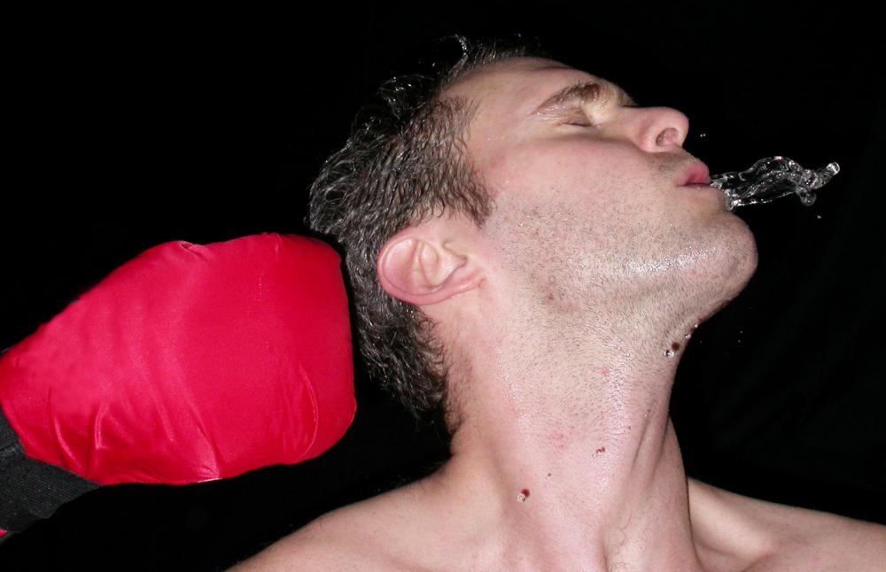 Prognathism may occur as a result of serious injury to the jaw.