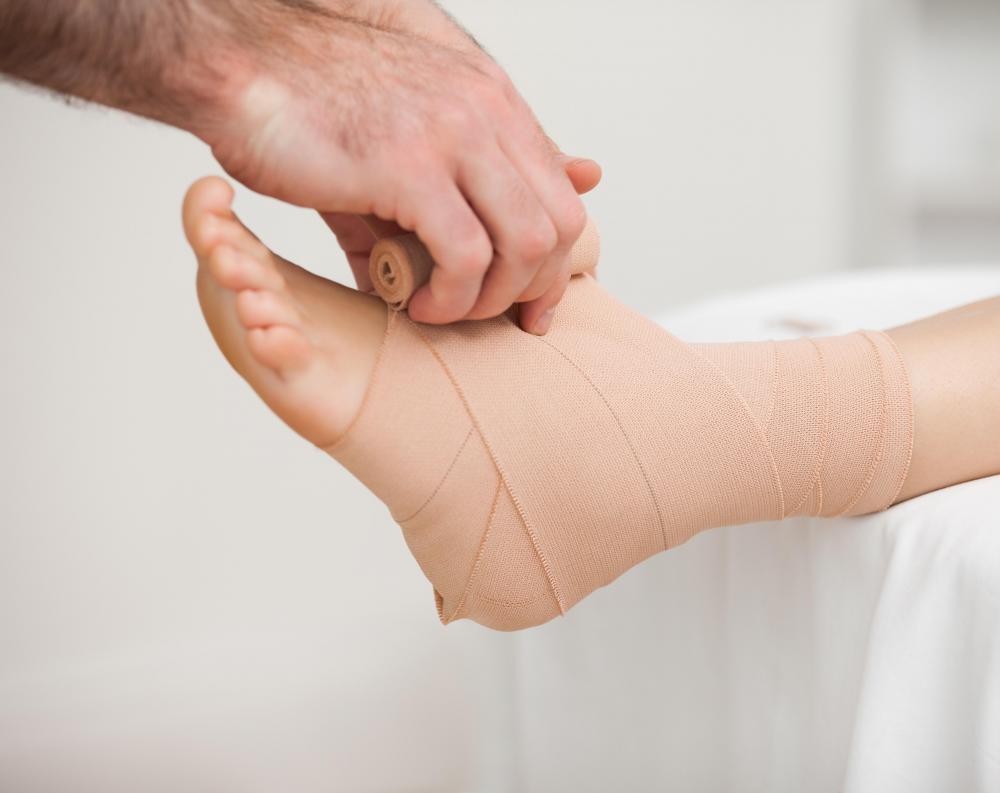It may be helpful for a patient with acral erythema to apply wound dressings to his or her hands and feet.