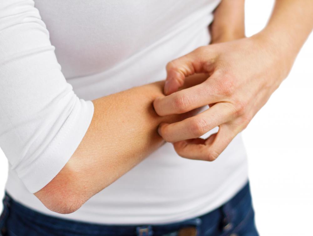 Sulphur has been used to treat skin conditions like eczema for hundreds if not thousands of years.