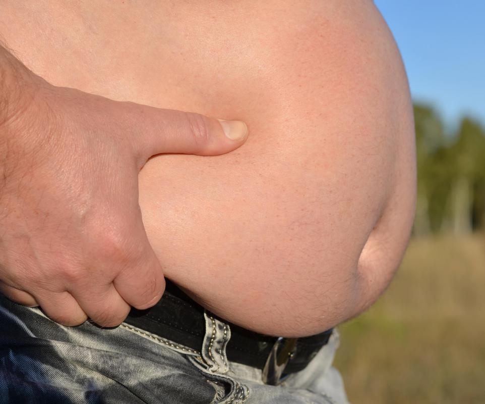 The superficial fascia often contains large deposits of fatty adipose tissue.