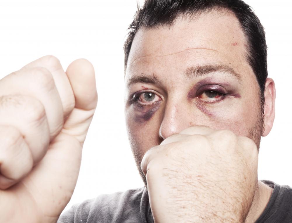 Mad-dogging may be a precursor to fighting or other physical violence.