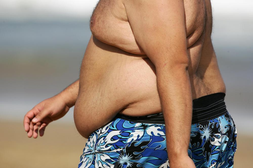 The obese tend to sweat more and are more predisposed to get a heat rash.