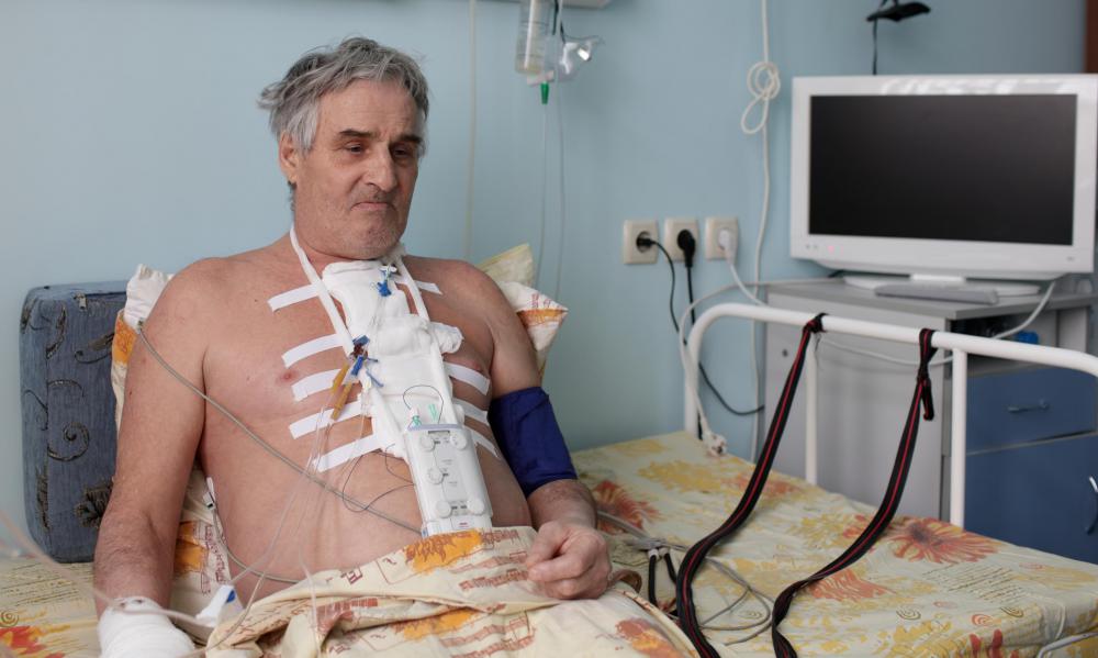 There are many reasons a pericardial window might be necessary.