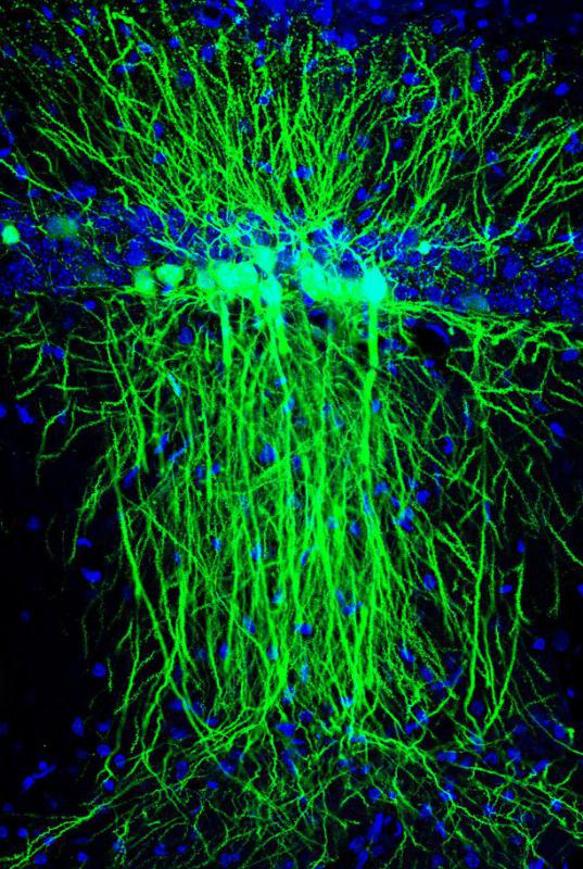 A phosphorescent photo of a neuron whose shape can change by stimuli and trauma.