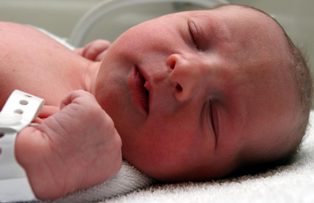 An infant ventilator may be required for a baby who is not breathing.