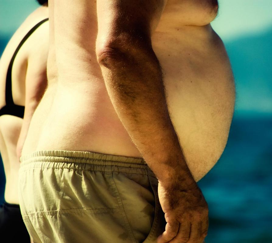 An obese individual may not meet the basic requirements for a brachioplasty.