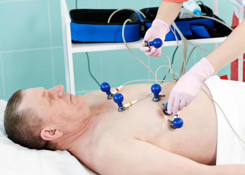 Heart palpitations should be evaluated by a doctor, even if they are believed to be related to diet pills.